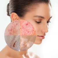 خدمات پوست و مو دکتر صدیقه ازومدلی